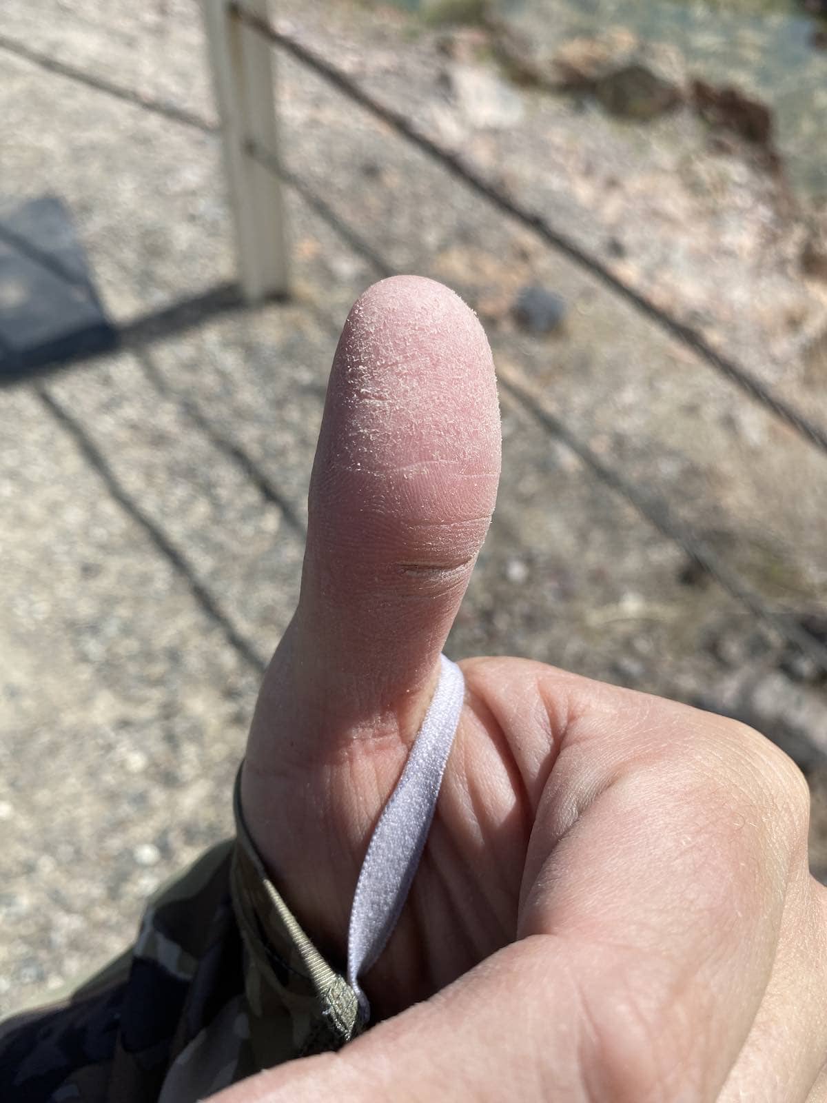Thumb scuffed by crappie teeth